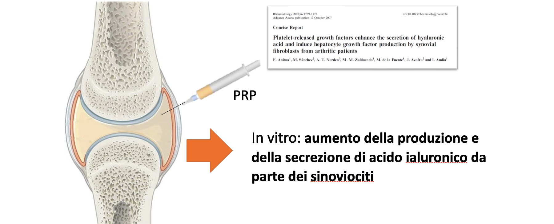 CONDROPROTEZIONE&E&LUBRIFICAZIONE&ARTICOLARE